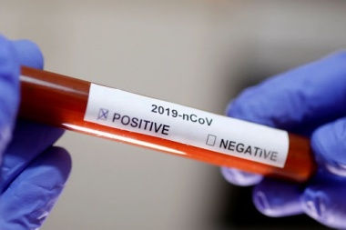 Coronavirus: otros dos contagios en Junín