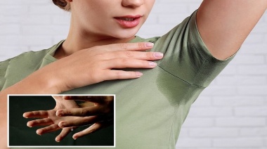 Qué es la hiperhidrosis