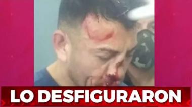 Presos desfiguraron a trompadas a Samuel Llanos, el femicida de Analía Maldonado