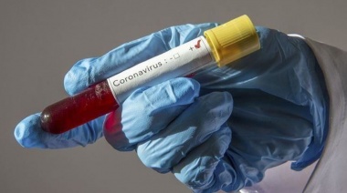 Los casos de coronavirus se disparan semana a semana: aumentaron 92%