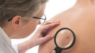 Sarcoma: un tumor que ataca los sostenes de nuestro cuerpo y no se puede prevenir