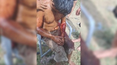 Batalla campal en el barrio Güemes: Heridos y una casa incendiada