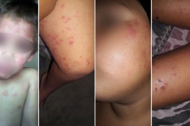 Menos agrotóxicos es más salud, un  reclamo que debiera ser de todos