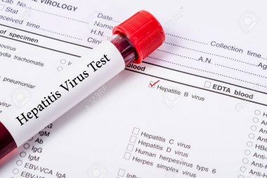Test gratuitos por Hepatitis C en la Farmacia Sindical