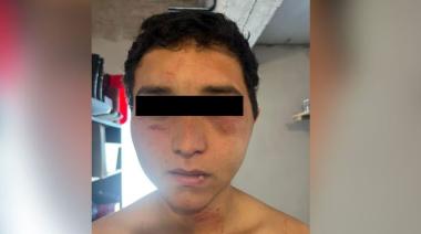 Habló el peón rural torturado por sus jefes en Vedia: "Me dijeron que me iban a paralizar el corazón"