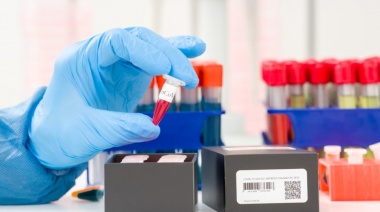 Coronavirus: Hubo 162 muertes y 8.632 contagios en las últimas 24 horas