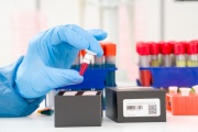 Coronavirus: Hubo 162 muertes y 8.632 contagios en las últimas 24 horas