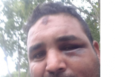 Liberaron al cortador de pasto: salió todo golpeado