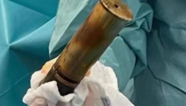 Entró con una bomba en su ano y tuvieron que evacuar un hospital