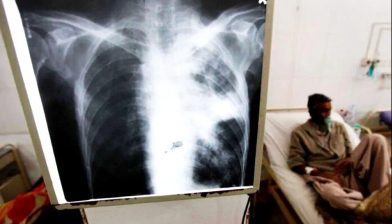 Mar del Plata: detectaron un caso de tuberculosis en un colegio