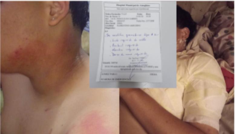 Grave episodio de violencia escolar: Un alumno resultó quemado tras una agresión en el aula