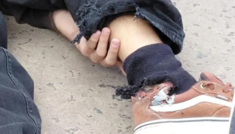 Evadió un control en moto, un policía le disparó con balas de goma y terminó operado