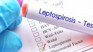 Dos casos fatales de leptospirosis en Córdoba