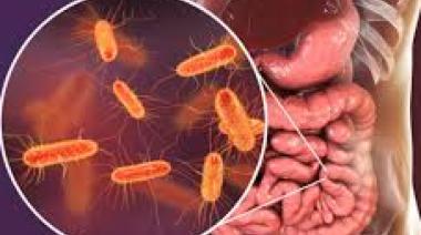 Confirman un brote de listeriosis por el consumo de un queso contaminado