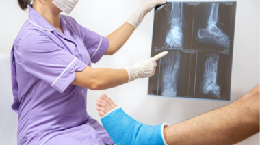Científicos chinos crean Bone 02, un gel que repara fracturas en 3 minutos