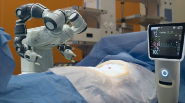 Realizaron la primera cirugía de válvula mitral asistida por robot