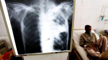 Mar del Plata: detectaron un caso de tuberculosis en un colegio