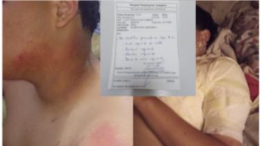 Grave episodio de violencia escolar: Un alumno resultó quemado tras una agresión en el aula