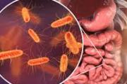 Confirman un brote de listeriosis por el consumo de un queso contaminado