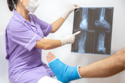 Científicos chinos crean Bone 02, un gel que repara fracturas en 3 minutos